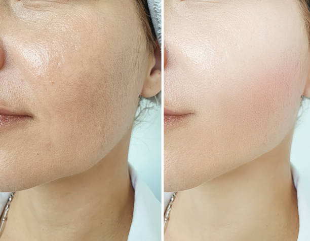 RU Cosmetics - Ultimate Repair Lotion